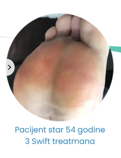 3 swift tretmana poslije 54 godine